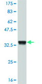 Monoclonal Anti-ATOX1 antibody produced in mouse clone 2E6, purified immunoglobulin, buffered aqueous solution