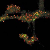 Anti-Sodium Channel Antibody, Voltage Gated, Pan (SP19 Segment) Chemicon&#174;, from rabbit