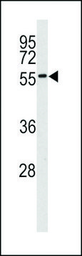 ANTI-MNK2 (MKNK2)(C-TERMINAL) antibody produced in rabbit IgG fraction of antiserum, buffered aqueous solution