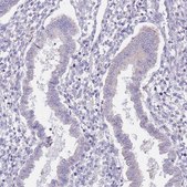 Anti-AP1S2 antibody produced in rabbit Prestige Antibodies® Powered by Atlas Antibodies, affinity isolated antibody, buffered aqueous glycerol solution