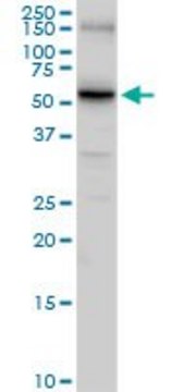 Anti-SLC14A1 antibody produced in rabbit purified immunoglobulin, buffered aqueous solution