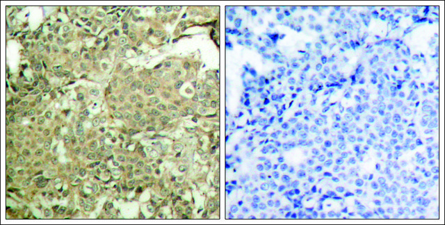 Anti-phospho-CFL1 (pSer3) antibody produced in rabbit affinity isolated antibody