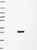 Anti-LMO2 antibody produced in rabbit Prestige Antibodies® Powered by Atlas Antibodies, affinity isolated antibody, buffered aqueous glycerol solution