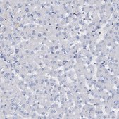 Anti-FAM155A antibody produced in rabbit Prestige Antibodies® Powered by Atlas Antibodies, affinity isolated antibody, buffered aqueous glycerol solution