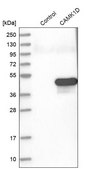 Anti-CAMK1D antibody produced in rabbit Prestige Antibodies® Powered by Atlas Antibodies, affinity isolated antibody, buffered aqueous glycerol solution