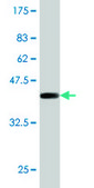 Monoclonal Anti-PIP5K3 antibody produced in mouse clone 6C7, purified immunoglobulin, buffered aqueous solution