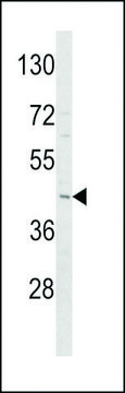 ANTI-ADIPOR1(C-TERMINAL) antibody produced in rabbit affinity isolated antibody, buffered aqueous solution