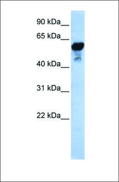 Anti-ALDH1B1 antibody produced in rabbit affinity isolated antibody