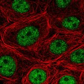 Anti-SF3B5 antibody produced in rabbit Prestige Antibodies® Powered by Atlas Antibodies, affinity isolated antibody, buffered aqueous glycerol solution
