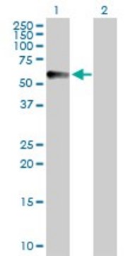 Anti-CPVL antibody produced in rabbit purified immunoglobulin, buffered aqueous solution