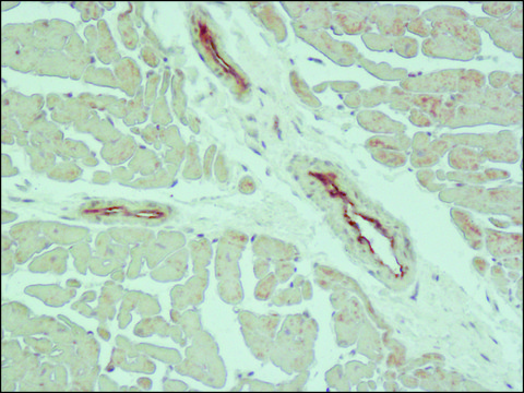 Anti-Claudin-5 (C-terminal) antibody produced in rabbit ~1.0&#160;mg/mL, affinity isolated antibody