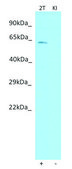 Anti-SEMA3E (C-terminal) antibody produced in rabbit affinity isolated antibody