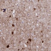 Anti-GAD1 antibody produced in rabbit Prestige Antibodies® Powered by Atlas Antibodies, affinity isolated antibody, buffered aqueous glycerol solution