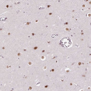 Anti-HNRNPDL antibody produced in rabbit Prestige Antibodies&#174; Powered by Atlas Antibodies, affinity isolated antibody, buffered aqueous glycerol solution