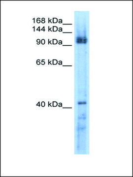 Anti-RECQL5 antibody produced in rabbit affinity isolated antibody