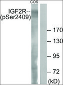 Anti-phospho-IGF2R (pSer2409) antibody produced in rabbit affinity isolated antibody