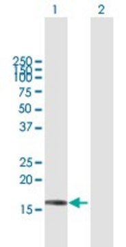 Anti-SRP19 antibody produced in mouse purified immunoglobulin, buffered aqueous solution