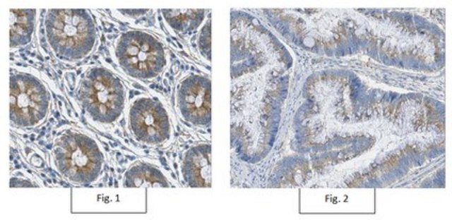 Anti-TNF&#945; Receptor Antibody, clone 13F9.1 clone 13F9.1, from mouse