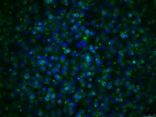 T24T Human Bladder Carcinoma Cell Line
