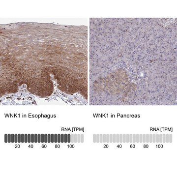 Anti-WNK1 antibody produced in rabbit Prestige Antibodies&#174; Powered by Atlas Antibodies, affinity isolated antibody, buffered aqueous glycerol solution