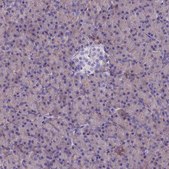 Anti-SPTLC3 antibody produced in rabbit Prestige Antibodies® Powered by Atlas Antibodies, affinity isolated antibody, buffered aqueous glycerol solution