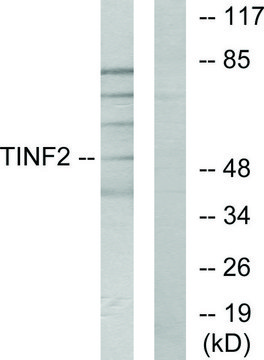 Anti-TINF2 antibody produced in rabbit affinity isolated antibody