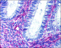 Anti-AGTR2 antibody produced in rabbit affinity isolated antibody