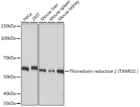 Anti-Thioredoxin reductase 2 (TXNRD2 ) Antibody, clone 4O1K0, Rabbit Monoclonal