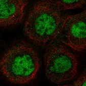 Anti-MSL1 antibody produced in rabbit Prestige Antibodies® Powered by Atlas Antibodies, affinity isolated antibody, buffered aqueous glycerol solution, Ab2