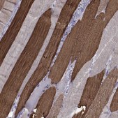 Anti-CHRNA1 antibody produced in rabbit Prestige Antibodies® Powered by Atlas Antibodies, affinity isolated antibody