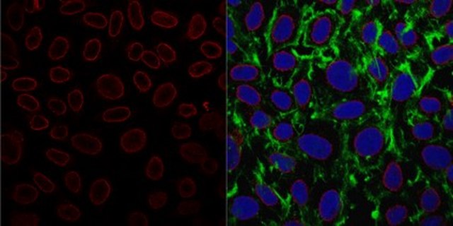 Anti-Nuclear Pore Complex Proteins Antibody, clone 414 clone 414, from mouse