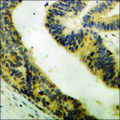 Anti-phospho-STK39 (pSer325) antibody produced in rabbit affinity isolated antibody