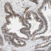 Anti-TPBG antibody produced in rabbit Prestige Antibodies® Powered by Atlas Antibodies, affinity isolated antibody, buffered aqueous glycerol solution