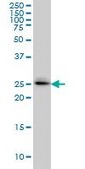 Monoclonal Anti-SPSB2 antibody produced in mouse clone 1E6, purified immunoglobulin, buffered aqueous solution
