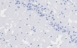 Anti-PSD95 Antibody, clone K28/43 ZooMAb® Mouse Monoclonal recombinant, expressed in HEK 293 cells