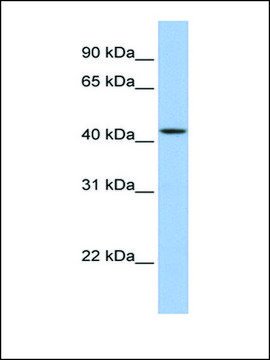 Anti-ZNF202 (AB2) antibody produced in rabbit affinity isolated antibody