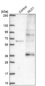 Anti-MLC1 antibody produced in rabbit Prestige Antibodies® Powered by Atlas Antibodies, affinity isolated antibody, buffered aqueous glycerol solution