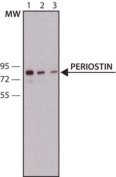 Anti-Periostin antibody,Mouse monoclonal clone 47, purified from hybridoma cell culture