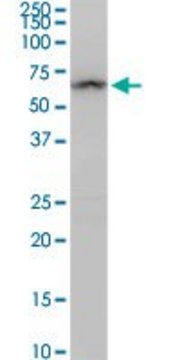 Anti-ALDH4A1 antibody produced in rabbit purified immunoglobulin, buffered aqueous solution