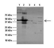 Anti-STUB1 antibody produced in rabbit affinity isolated antibody