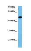Anti-ACVR1 affinity isolated antibody
