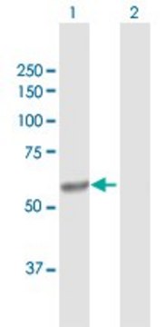 Anti-CYP4V2 antibody produced in rabbit purified immunoglobulin, buffered aqueous solution