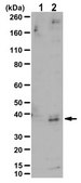 Anti-acetyl-GAPDH (Lys160) Antibody 0.5 mg/mL, from rabbit
