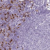 Anti-LAMP3 antibody produced in rabbit Prestige Antibodies® Powered by Atlas Antibodies, affinity isolated antibody, buffered aqueous glycerol solution