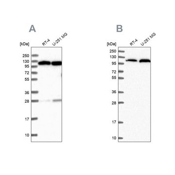 Anti-AARS antibody produced in rabbit Prestige Antibodies&#174; Powered by Atlas Antibodies, affinity isolated antibody, buffered aqueous glycerol solution