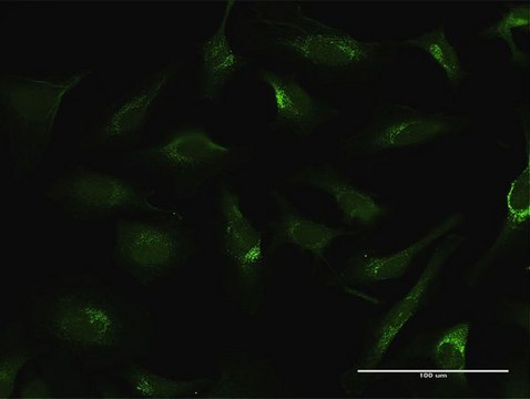 Anti-FTL antibody produced in rabbit purified immunoglobulin, buffered aqueous solution