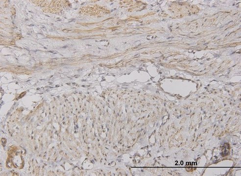 Monoclonal Anti-CXCL5 antibody produced in mouse clone 2A9, purified immunoglobulin, buffered aqueous solution