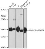 Anti- CDKN1B/p27KIP1 antibody produced in rabbit