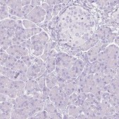 Anti-SLC27A5 antibody produced in rabbit Prestige Antibodies® Powered by Atlas Antibodies, affinity isolated antibody, buffered aqueous glycerol solution