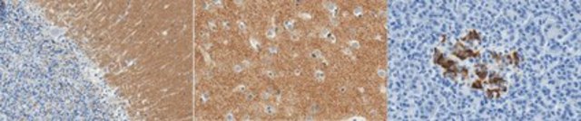 Anti-Synaptophysin Antibody, clone 10F6.1 clone 10F6.1, from mouse